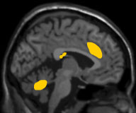 نام: mri_love_side.jpg نمایش: 126 اندازه: 6.0 کیلو بایت