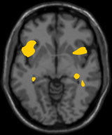 نام: mri_love_top.jpg نمایش: 127 اندازه: 6.3 کیلو بایت